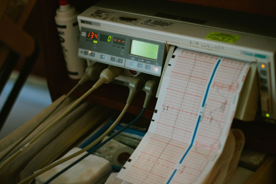 EKG uređaj prikazuje rezultate rada srca u bolničkom okruženju